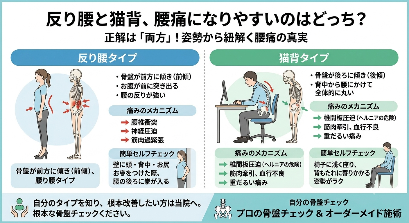 反り腰と猫背を分類したイラスト