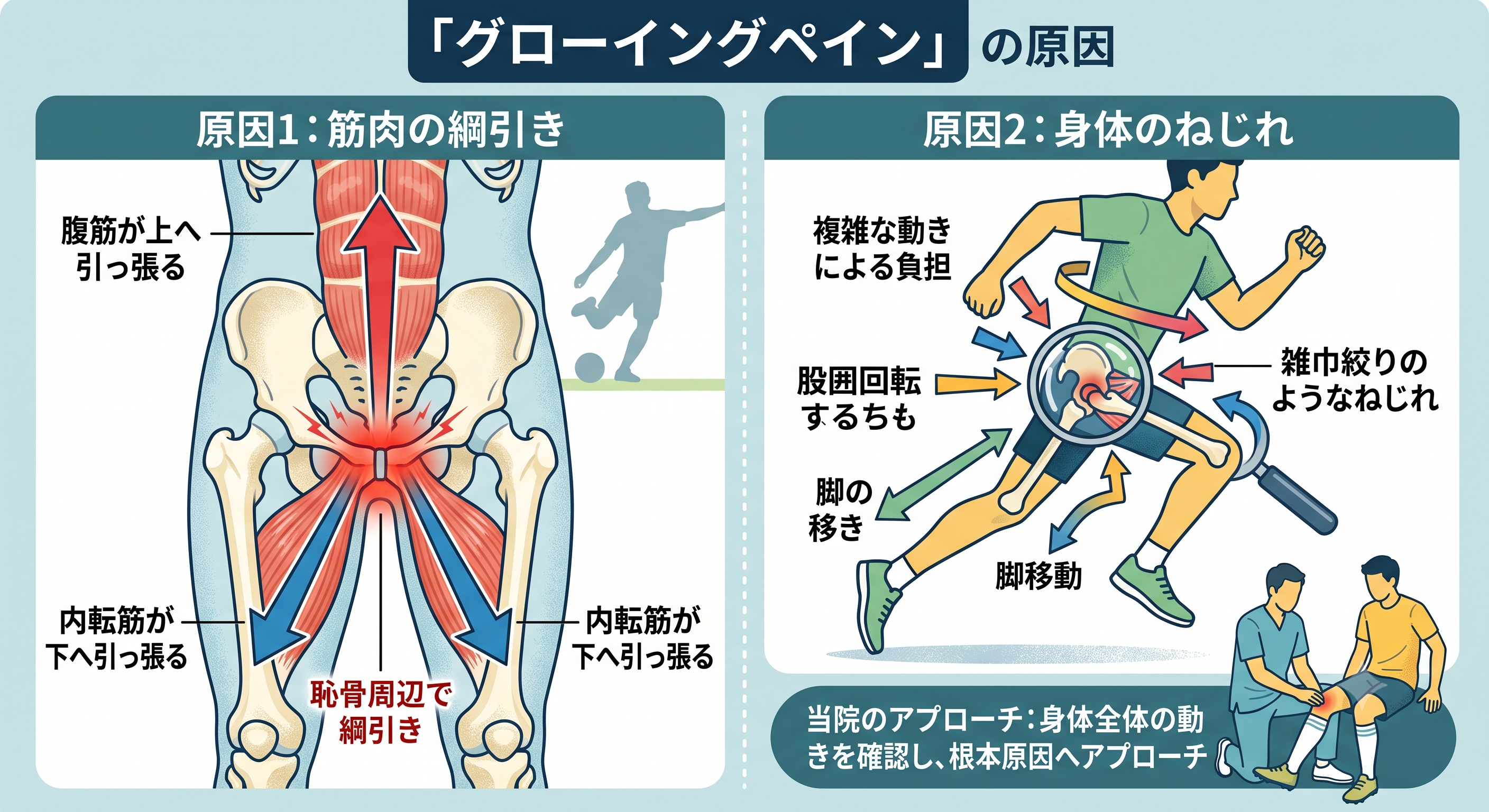 グロインペインの「2大原因」解説図